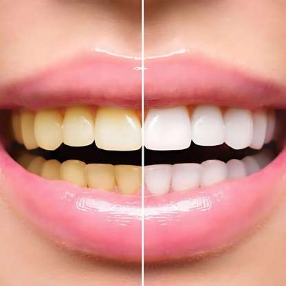 HiSmile V34 Colour Corrector – Purple Teeth Whitening Serum